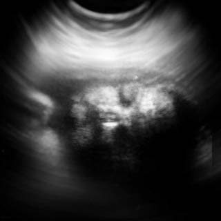 تصویر دو بعدی هفته سی و سوم بارداری - عکس جنین در هفته سی و دوم بارداری