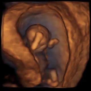 تصویر سه بعدی هفته یازدهم بارداری