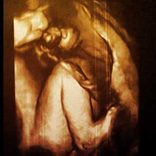 تصویر دو بعدی سی و دوم بارداری