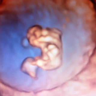 تصویر سه بعدی هفته هشتم بارداری