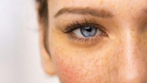 غذاهایی که باعث حلقه های تیره زیر چشم می شوند غذاهایی که باعث حلقه های تیره زیر چشم می شوند