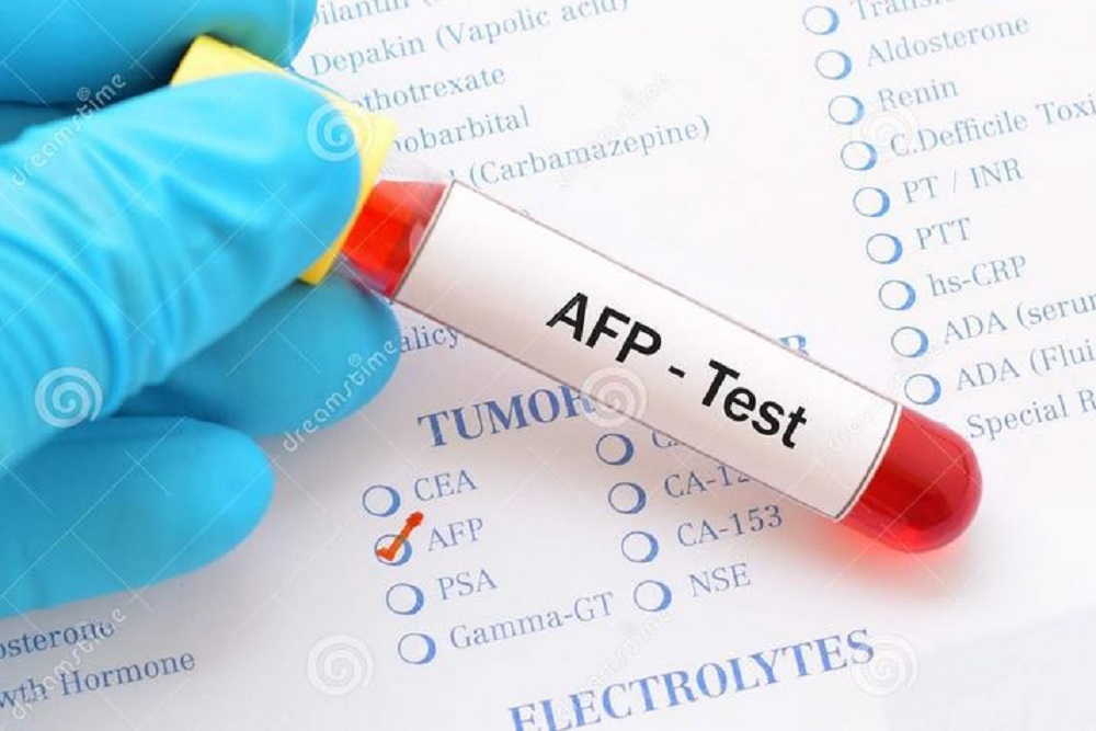 afp test