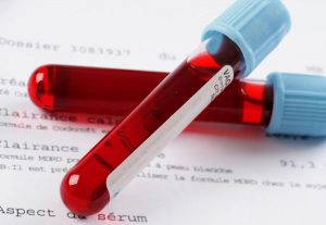 تست اسید لاکتیک تست اسید لاکتیک