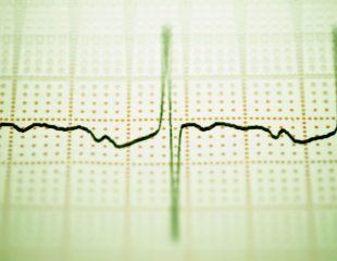 شرح حال و معاینه ی بالینی ضربان قلب سریع