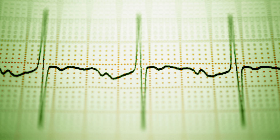 شرح حال و معاینه ی بالینی ضربان قلب سریع