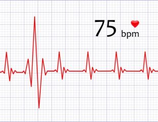 آریتمی - بیماری قلبی و ریتم غیر طبیعی قلب