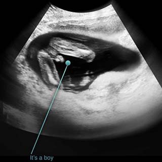 تصویر دو بعدی هفته شانزدهم بارداری - عکس جنین در هفته شانزدهم بارداری