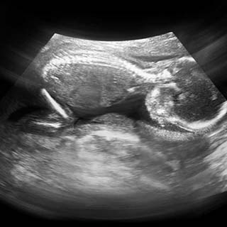 تصویر دو بعدی هفته نوزدهم بارداری - عکس جنین در هفته نوزدهم بارداری