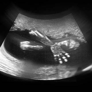 تصویر دو بعدی هفته بیست و دوم بارداری - عکس جنین در هفته بیست و دوم بارداری