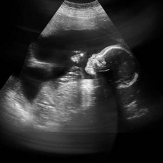 تصویر دو بعدی هفته بیست و سوم بارداری - عکس جنین در هفته بیست و سوم بارداری