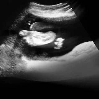 تصویر دو بعدی هفته بیست و چهارم بارداری - عکس جنین در هفته بیست و چهارم بارداری
