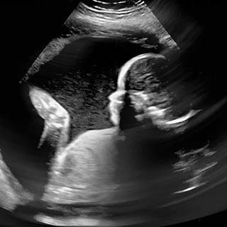 تصویر دو بعدی هفته بیست و ششم بارداری - عکس جنین در هفته بیست و ششم بارداری