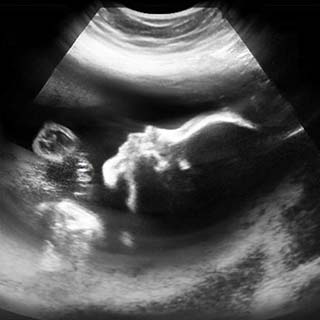 تصویر دو بعدی هفته بیست و هشتم بارداری - عکس جنین در هفته بیست و هشتم بارداری