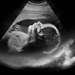 تصویر دو بعدی هفته بیست و نهم بارداری - عکس جنین در هفته بیست و نهم بارداری