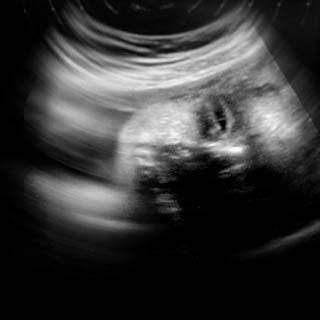 تصویر دو بعدی هفته سی و چهارم بارداری - عکس جنین در هفته سی و چهارم بارداری