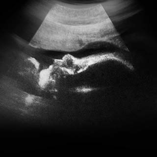 تصویر دو بعدی هفته سی و ششم بارداری - عکس جنین در هفته سی و ششم بارداری