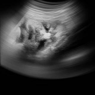 تصویر دو بعدی هفته سی و هفتم بارداری - عکس جنین در هفته سی و هفتم بارداری