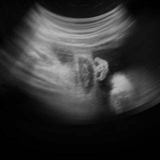 تصویر دو بعدی هفته سی و هشتم بارداری - عکس جنین در هفته سی و هشتم بارداری