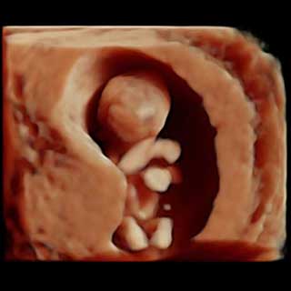 تصویر سه بعدی هفته دوازدهم بارداری - سونوگرافی جنین در هفته دوازدهم بارداری