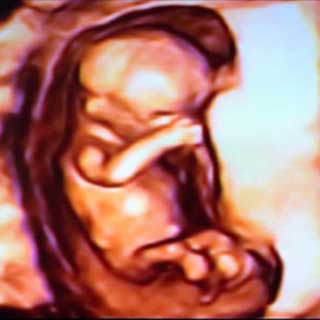 تصویر سه بعدی هفته چهاردهم بارداری - سونوگرافی در هفته چهاردهم بارداری