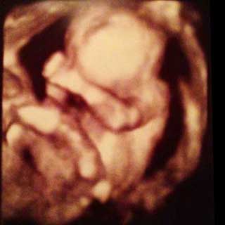 تصویر سه بعدی هفته پانزدهم بارداری