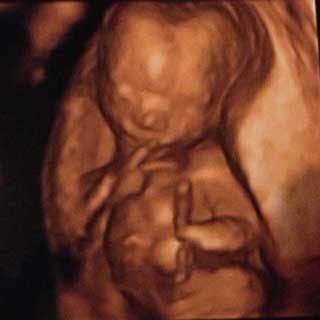 تصویر سه بعدی هفته شانزدهم بارداری