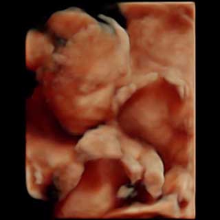 تصویر سه بعدی هفته بیست و یکم بارداری