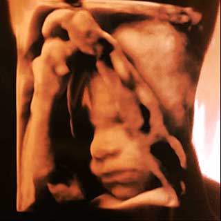 تصویر سه بعدی هفته بیست و دوم بارداری