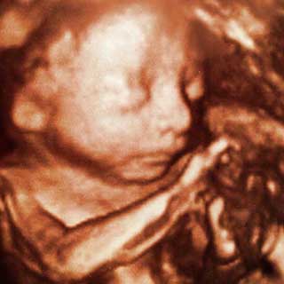 تصویر سه بعدی هفته بیست و چهارم بارداری