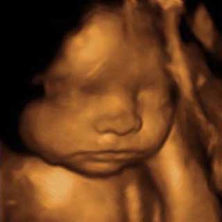 تصویر سه بعدی هفته بیست و پنجم بارداری