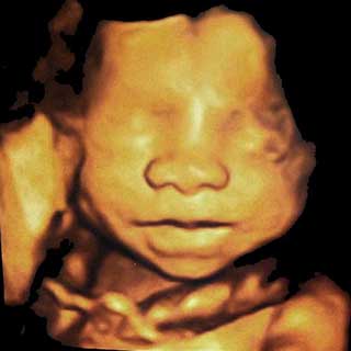 تصویر سه بعدی هفته بیست و ششم بارداری