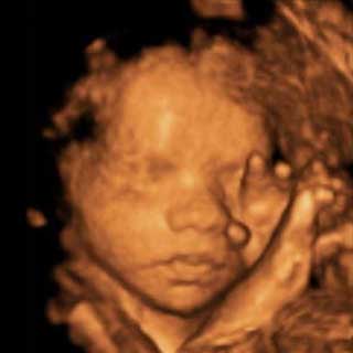 تصویر سه بعدی هفته بیست و هفتم بارداری