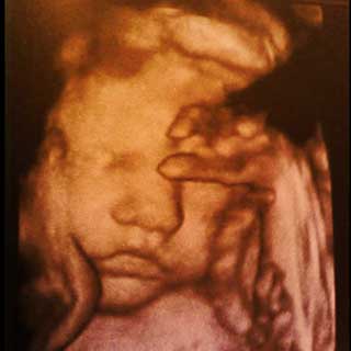 تصویر دو بعدی سی و یکم بارداری