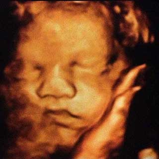 تصویر دو بعدی سی و چهارم بارداری