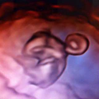 تصویر سه بعدی هفته هشتم بارداری