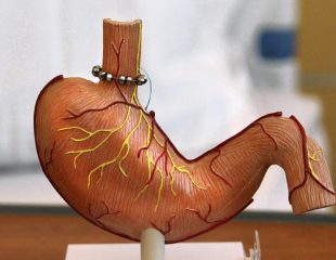 درمان سوزش سر دل با جراحی