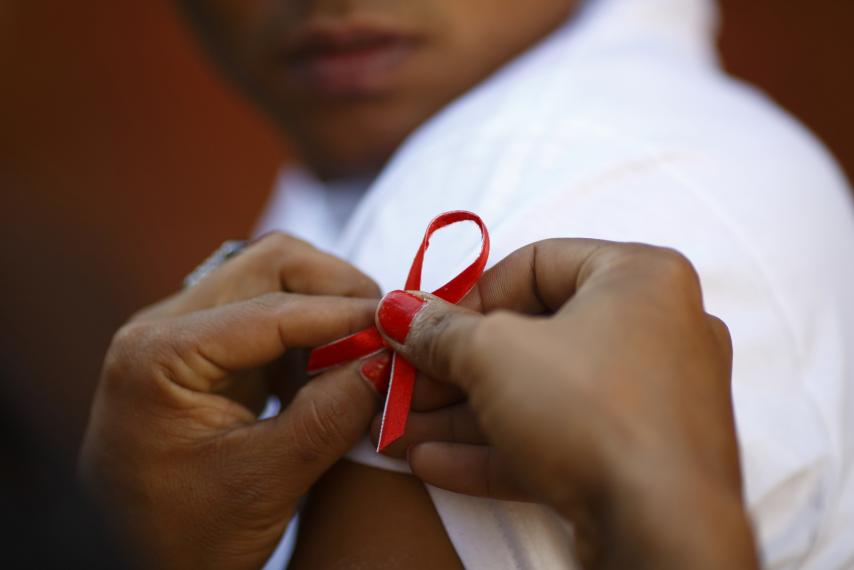 پیشگیری از عفونت های همراه ایدز / اچ آی وی