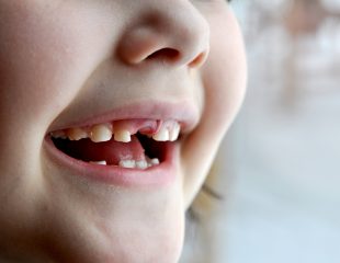 مشکلات سلامت دهان کودکان