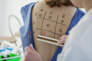 آزمایش های تشخیص آلرژی غذایی آزمایش های تشخیص آلرژی غذایی