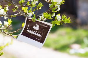 بارداری طبیعی و علائم آن بارداری طبیعی و علائم آن
