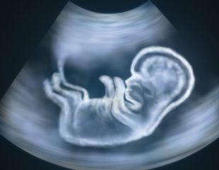 بررسی ناهنجاری های جنینی در طی بارداری