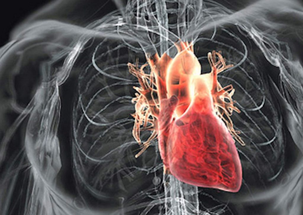 آنژیوگرافی در بیماری های قلبی