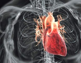 آنژیوگرافی در بیماری های قلبی