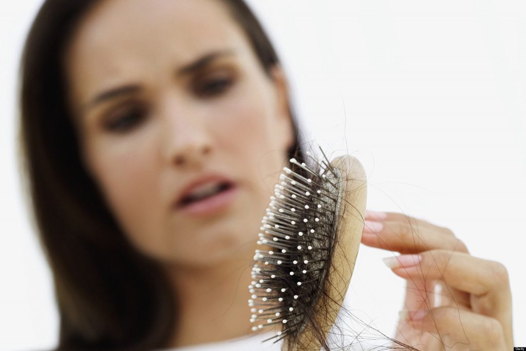 ریزش موی زنان