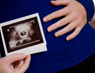 اولین تصویر برداری در دوران بارداری با استفاده از سونوگرافی