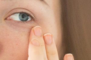 حلقه های تیرۀ ارثی زیر چشم حلقه های تیرۀ ارثی زیر چشم