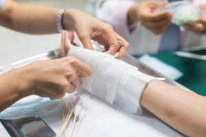 درد ناشی از سوختگی درد ناشی از سوختگی