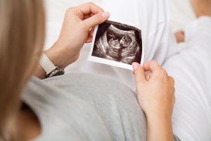 تست غربالگری نوکال ترانس لوسنسی ( NT ) تست غربالگری نوکال ترانس لوسنسی ( NT )