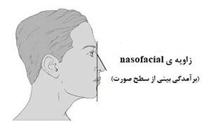 زاویه ی ایده آل nasofacial