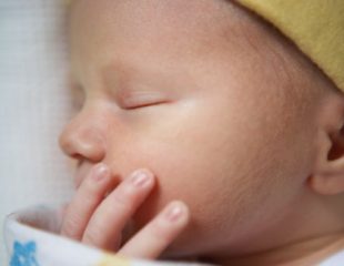 نکاتی در مورد پوست نوزاد تازه متولد شده